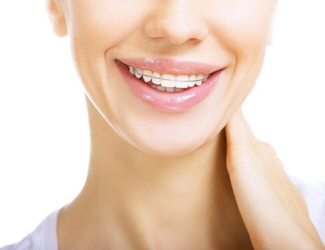 além dos dentes tortos instituto novva