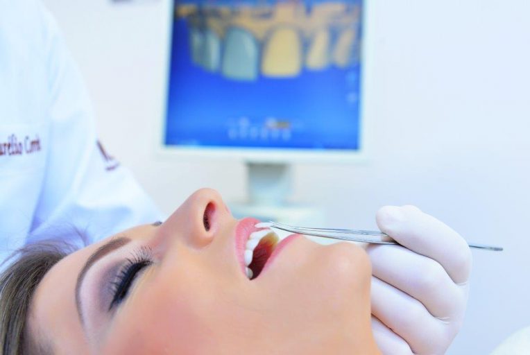 lentes de contato dental são mais populares que silicone e lipo instituto novva